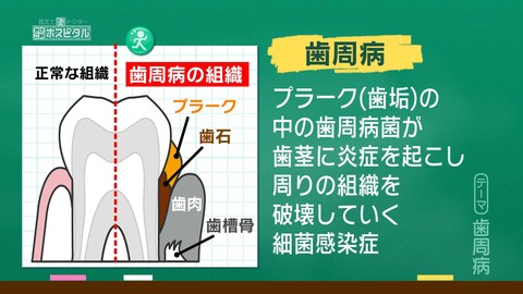 金曜スパイス 教えてドクター かけこみホスピタル 日本海テレビ